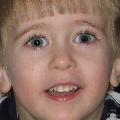 young boy giving goofy grin to camera